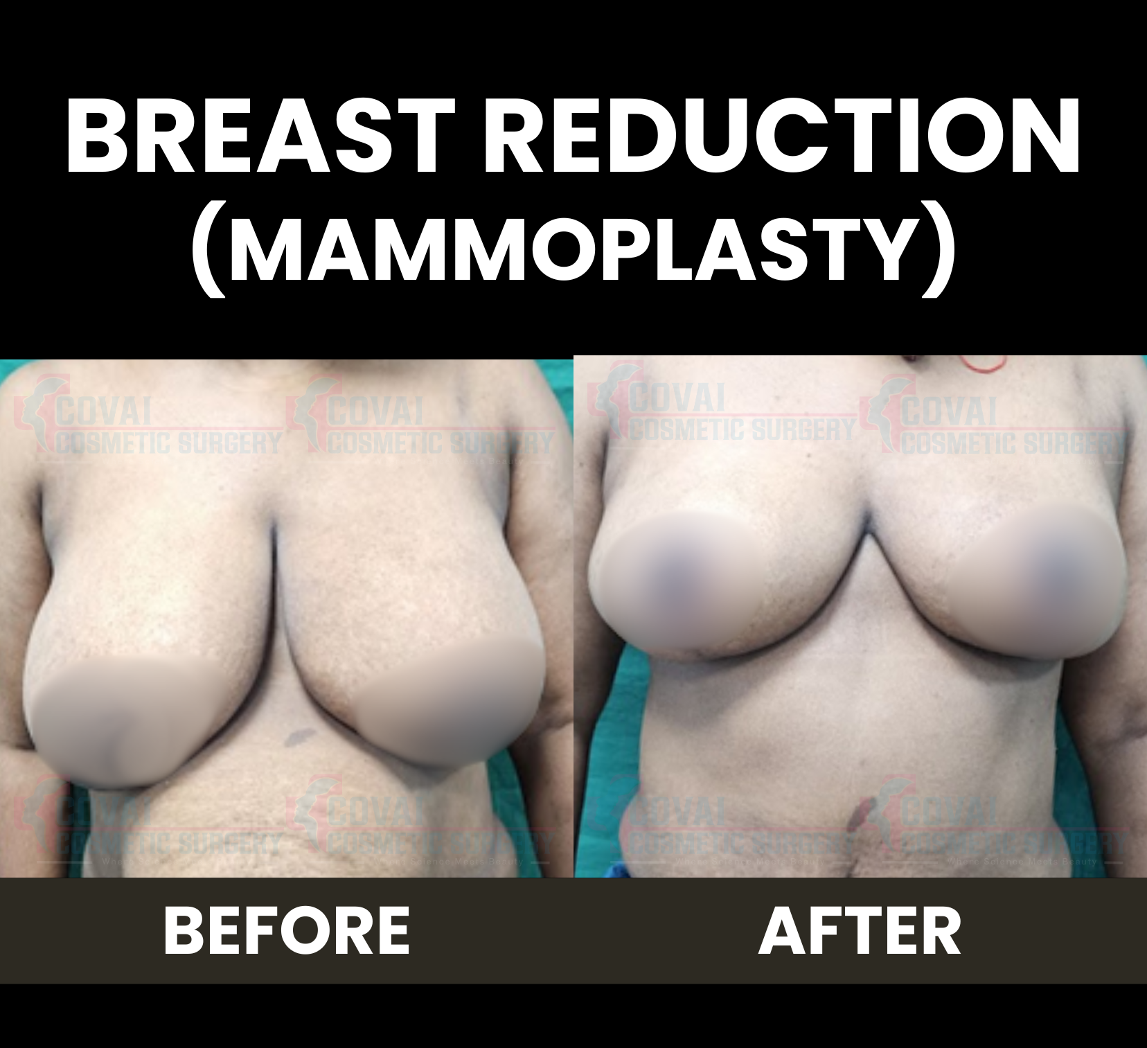Before After