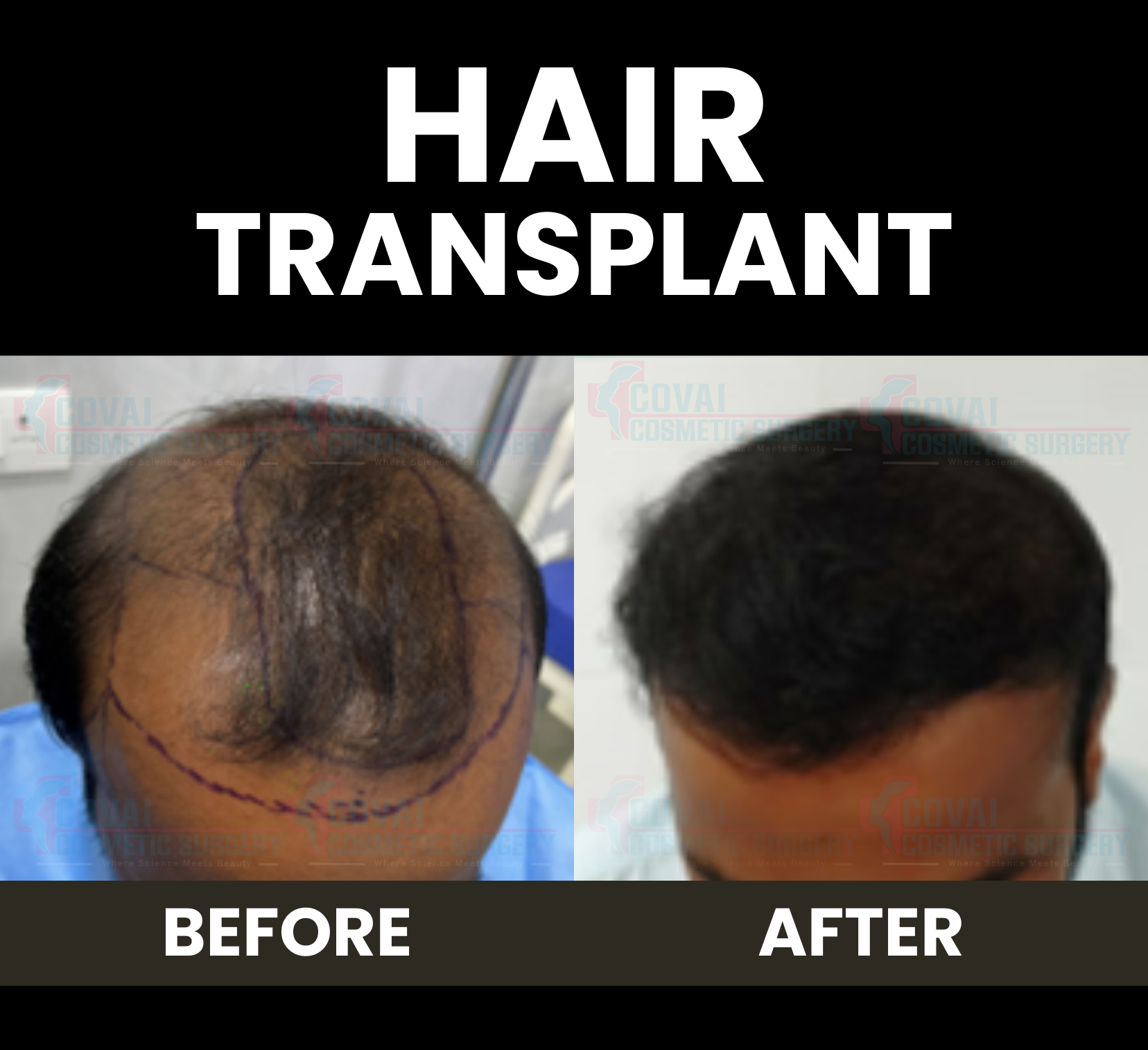 Before After